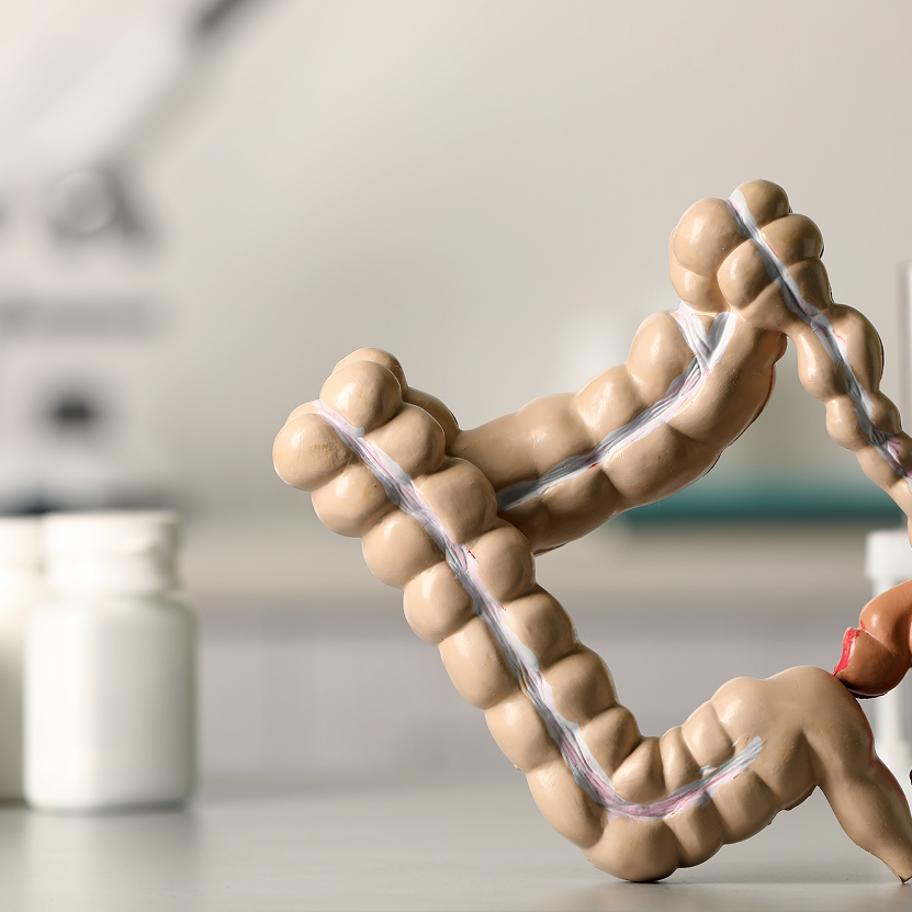 Early Colon Cancer Signs: What to Watch For at Every Age