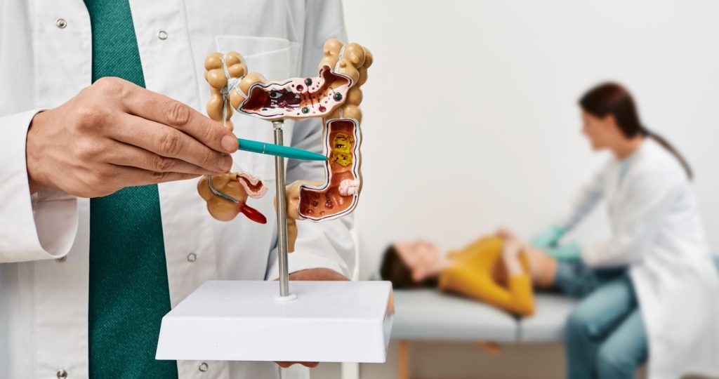 Found Polyps in Colon During Your Colonoscopy? Here's What Happens Next